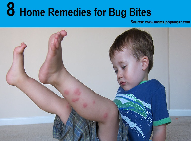 8 Home Remedies for Bug Bites