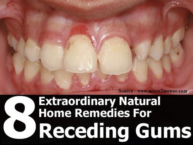 8 Extraordinary Natural Home Remedies For Receding Gums