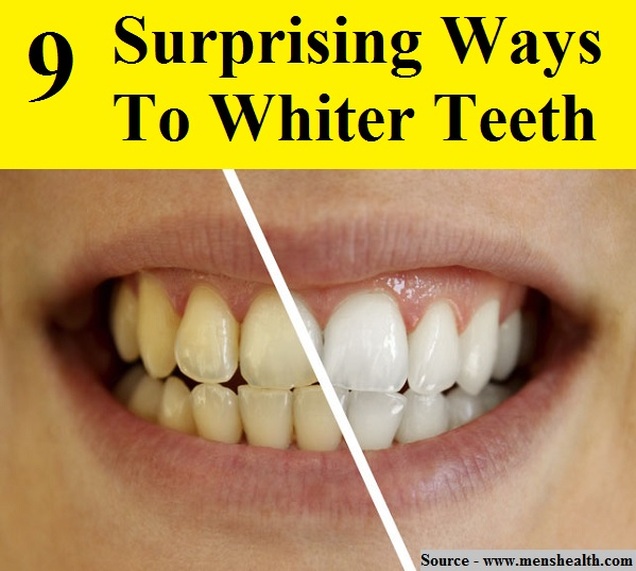 9 Surprising Ways To Whiter Teeth
