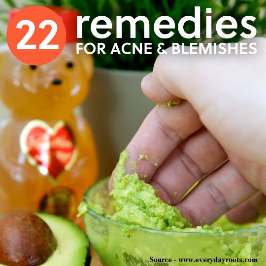 22 Home Remedies For Acne And Blemishes