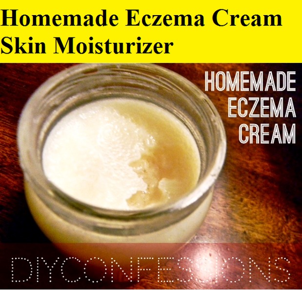 Homemade Eczema Cream Skin Moisturizer
