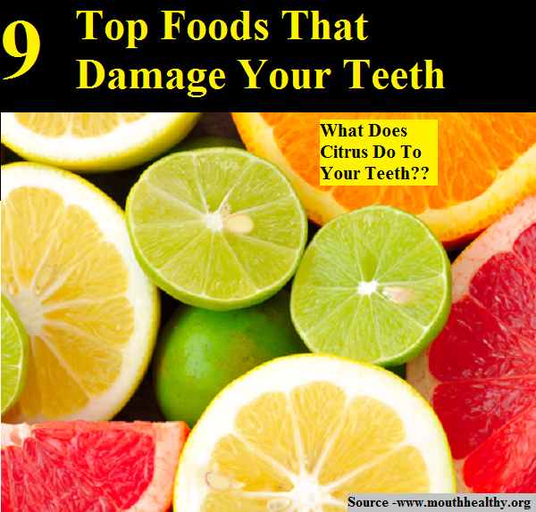 9 Top Foods That Damage Your Teeth
