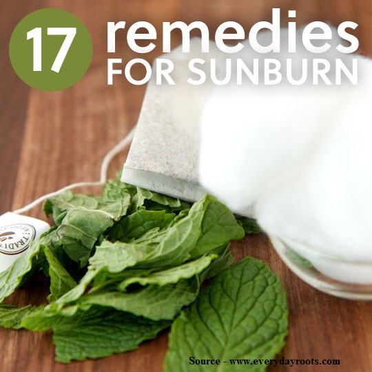 17 Natural Remedies For Sunburns