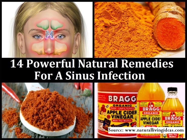 14 Powerful Natural Remedies for a Sinus Infection