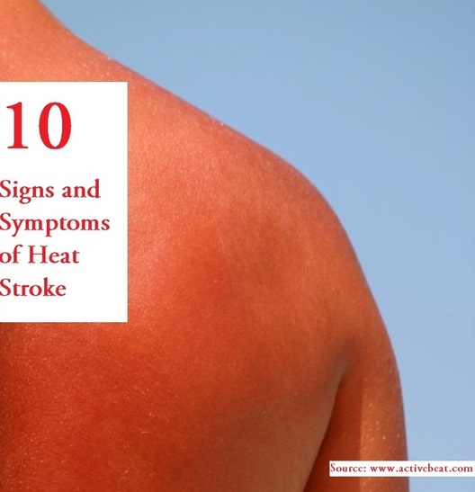 10 Signs and Symptoms of Heat Stroke