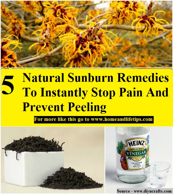 5 Natural Sunburn Remedies To Instantly Stop Pain And Prevent Peeling